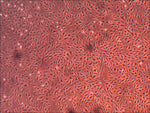 Cell Systems Primary Human Venous Endothelial Cells (CSC 2V0)