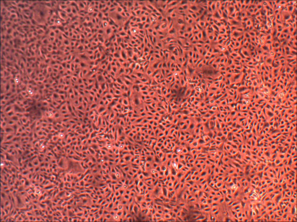 お歳暮ならオンライン Microvascular Lung Human Primary Endothelial (ACBRI Cells フェイスクリーム