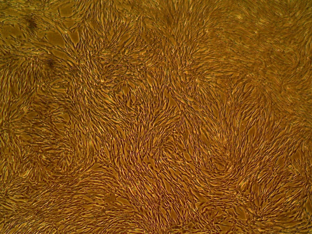 Cell Systems Primary Human Synovial Stromal Cells (ACBRI 479) 