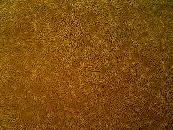 Primary Human Aortic Smooth Muscle Cells - Cell Systems