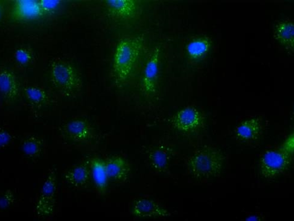 Primary Human Dermal Microvascular Endothelial Cells (CSC 2M1)