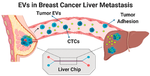 Microfluidic Device from Primary Human Cells Sheds Light on Cancer Mechanism