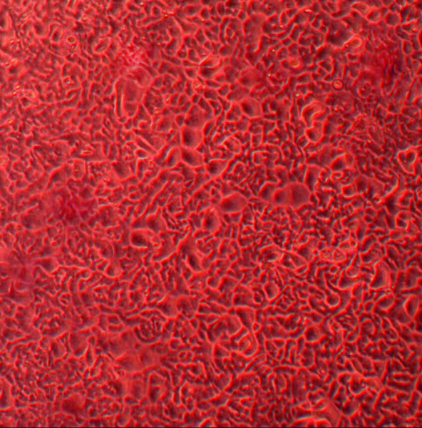 Human Primary Keratinocytes (ACBRI 2K0) Cell Systems