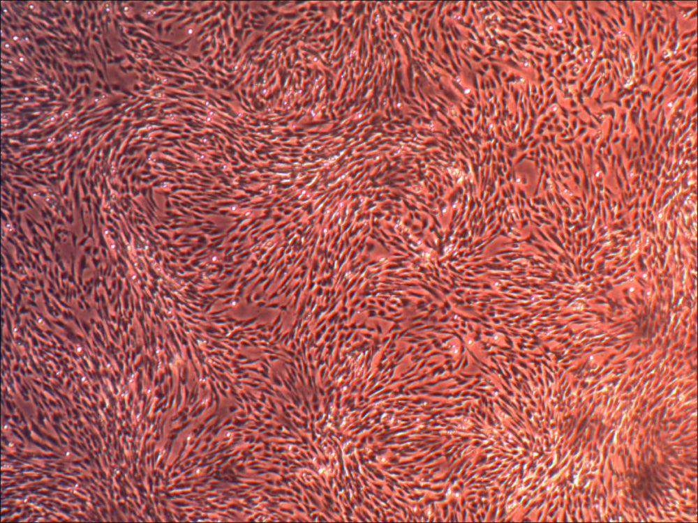 Primary Human Glomerular Mesangial Cells (ACBRI 127)
