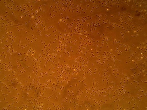 Primary Human Glomerular Microvascular Endothelial Cells Day 2 ACBRI 128
