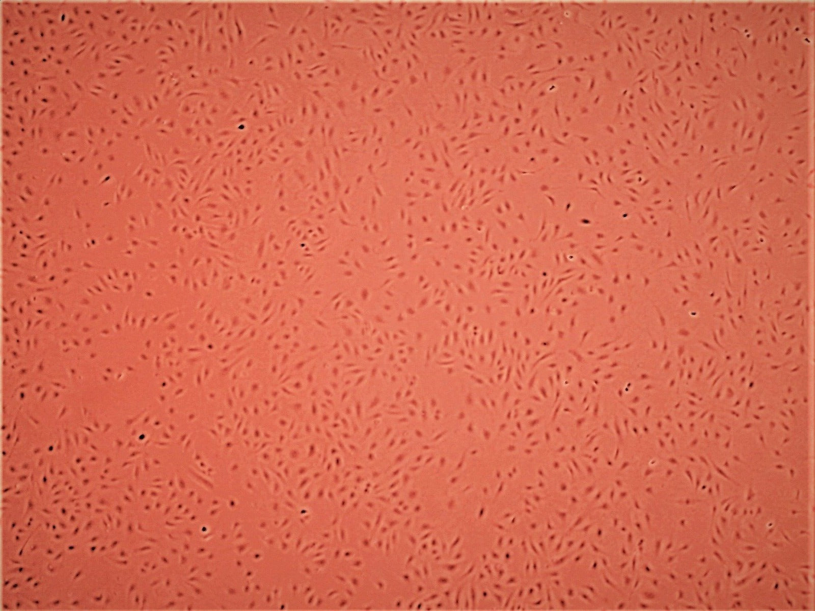 Primary Human Glomerular Mesangial Cells (ACBRI 127)