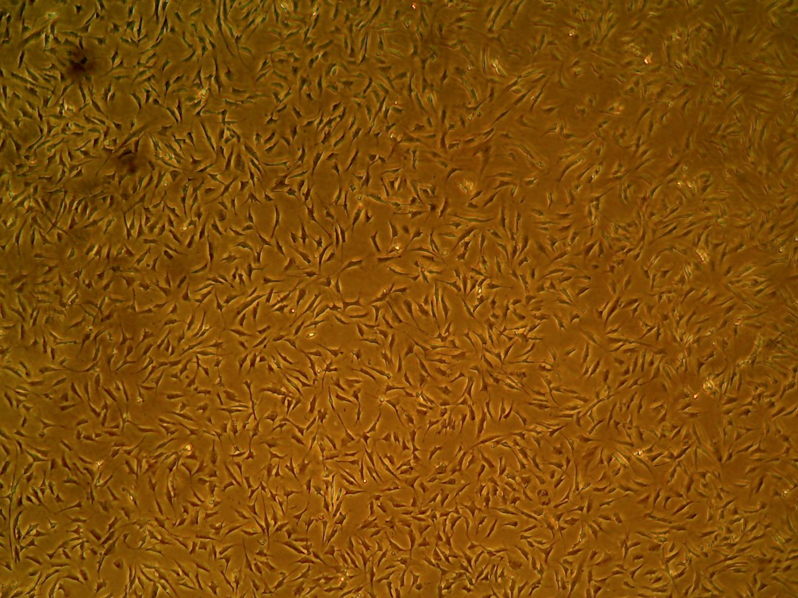 Primary Human Glomerular Mesangial Cells (ACBRI 127)
