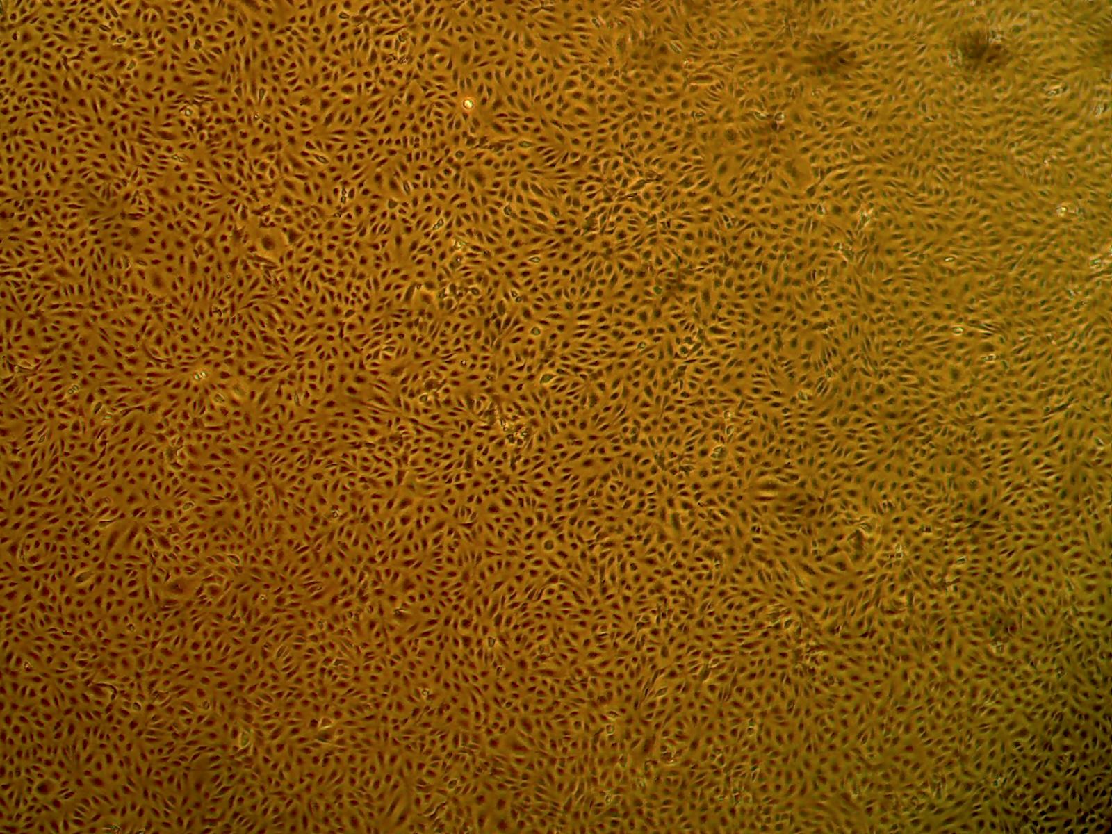 Primary Human Glomerular Mesangial Cells (ACBRI 127)