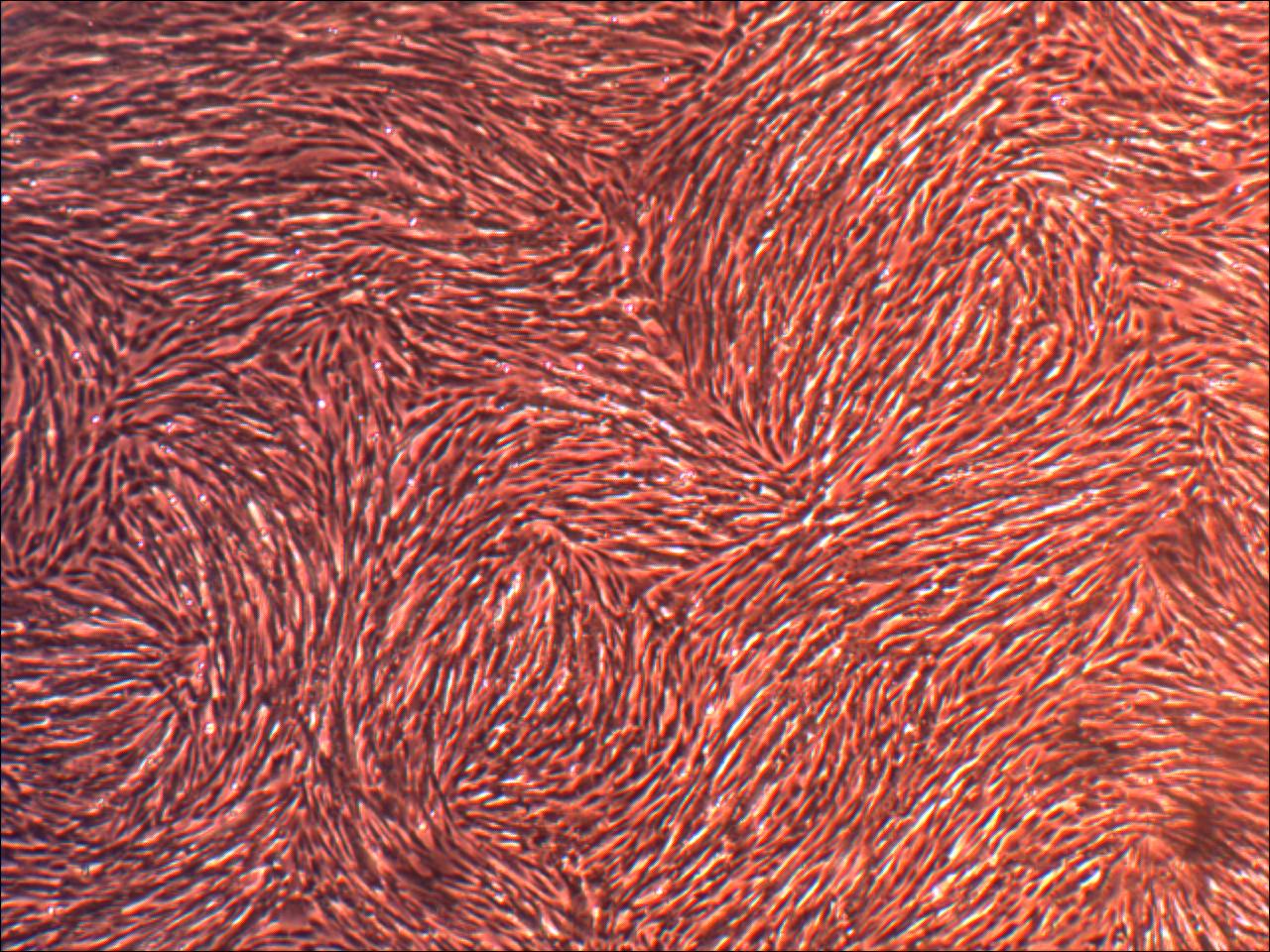 Primary Human Glomerular Mesangial Cells (ACBRI 127)
