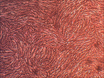 Primary Human Dermal Fibroblast Cells (CSC 2F0)