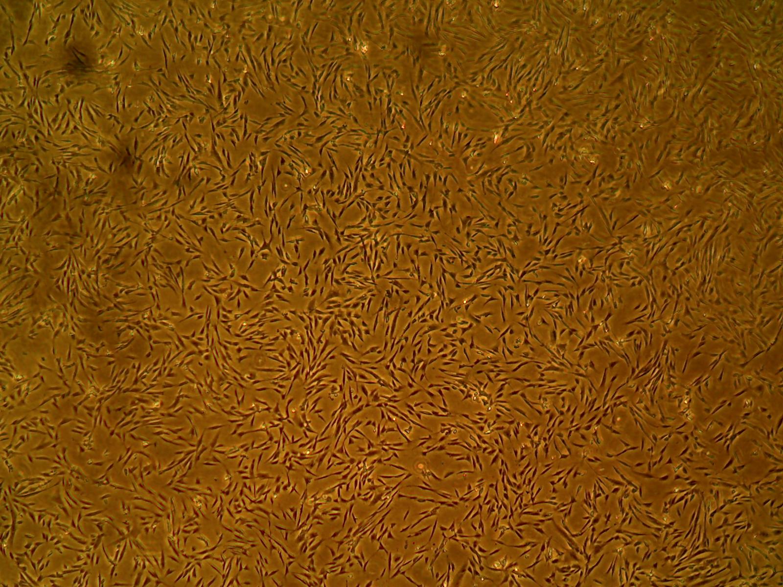 Primary Human Glomerular Mesangial Cells (ACBRI 127)