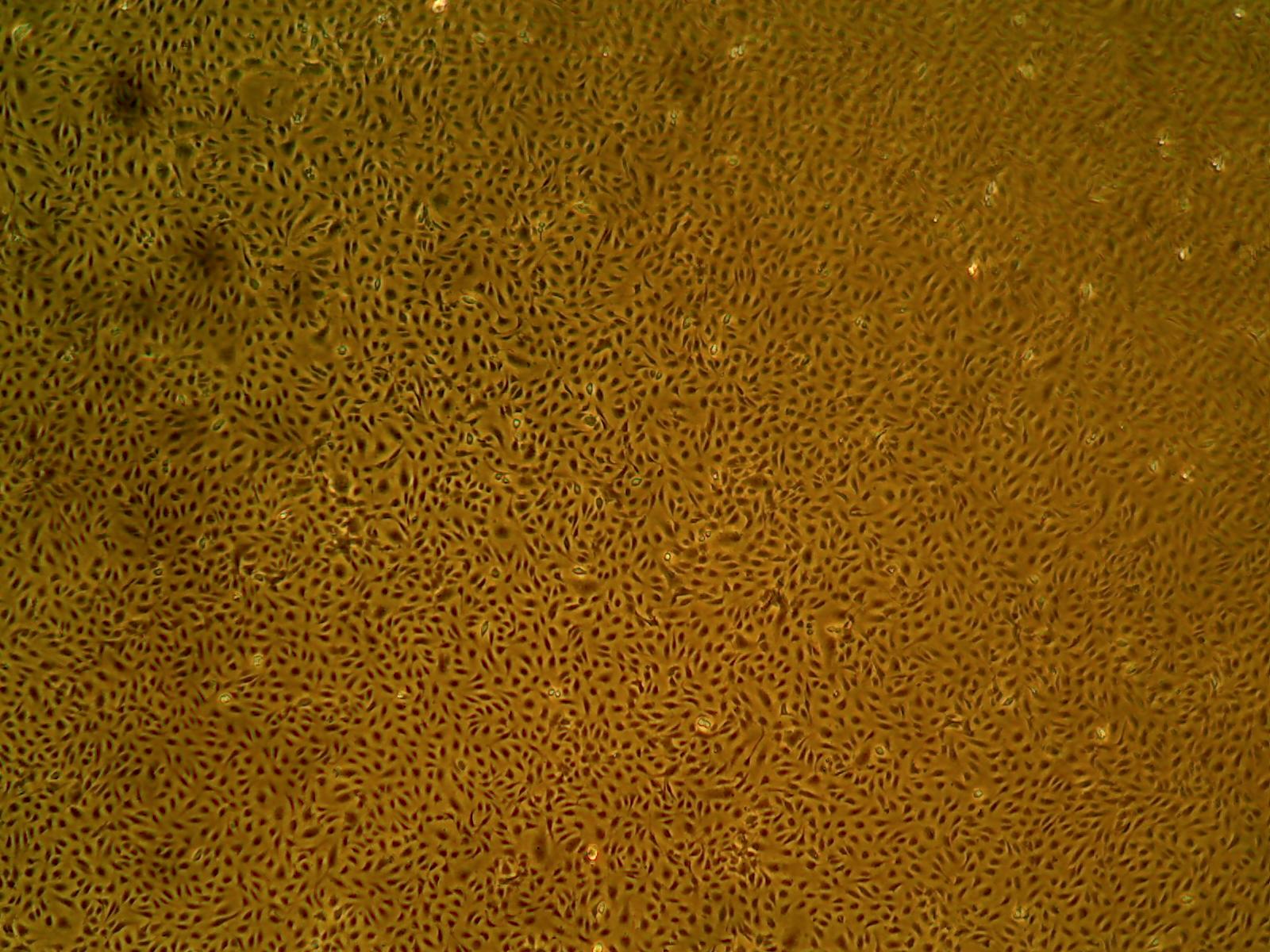 Primary Human Glomerular Mesangial Cells (ACBRI 127)
