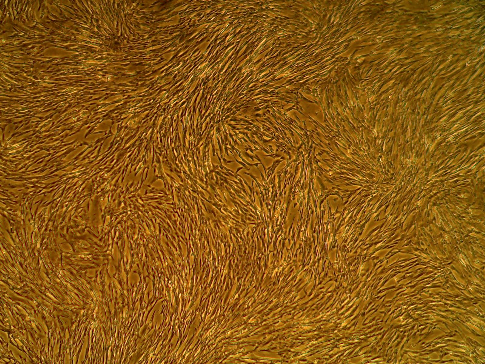 Primary Human Glomerular Mesangial Cells (ACBRI 127)