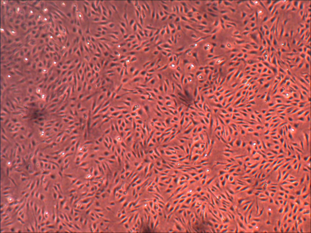 Primary Human Glomerular Mesangial Cells (ACBRI 127)