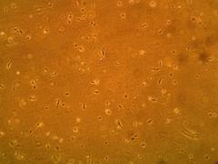 Primary Human Glomerular Mesangial Cells (ACBRI 127)