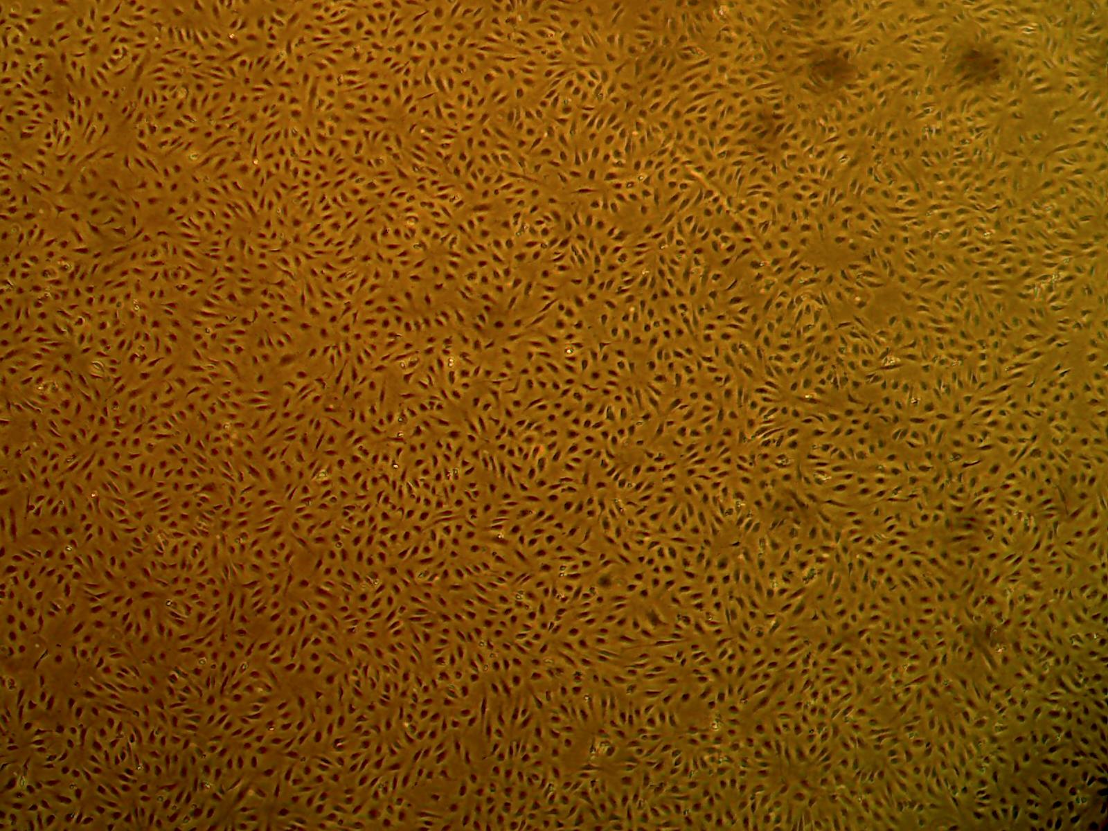 Primary Human Glomerular Mesangial Cells (ACBRI 127)