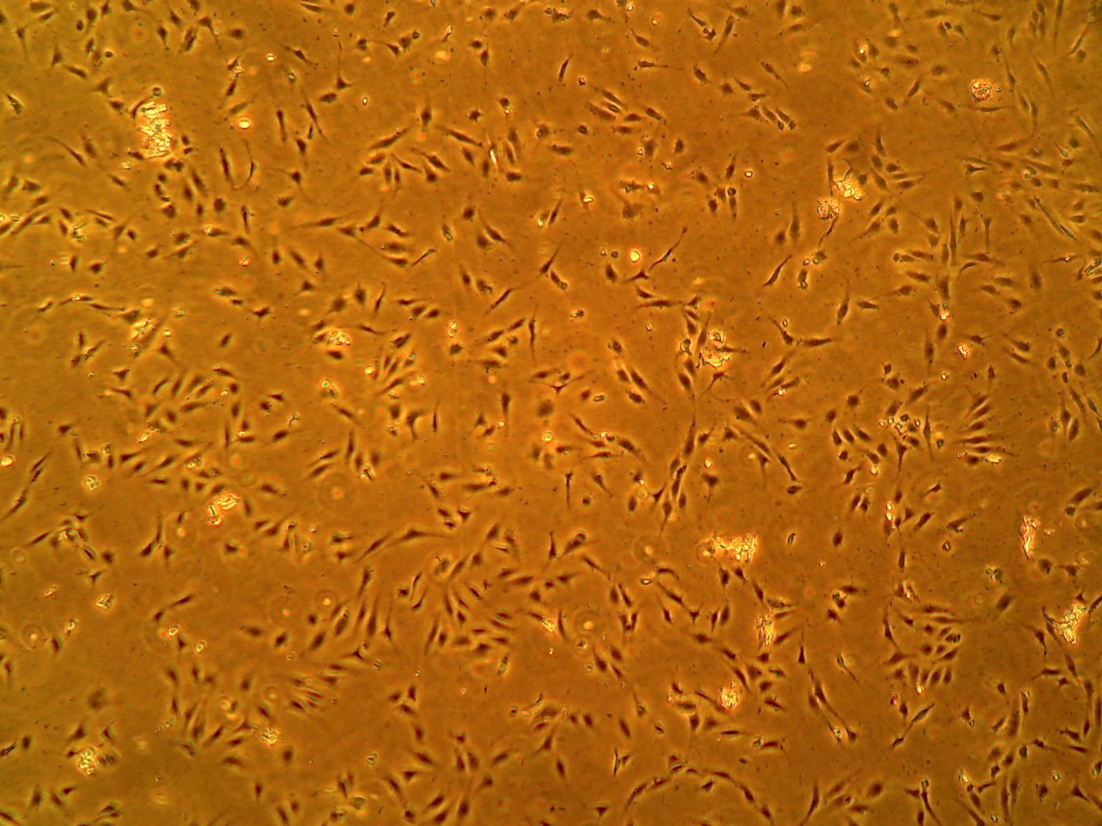 Primary Human Glomerular Mesangial Cells (ACBRI 127)