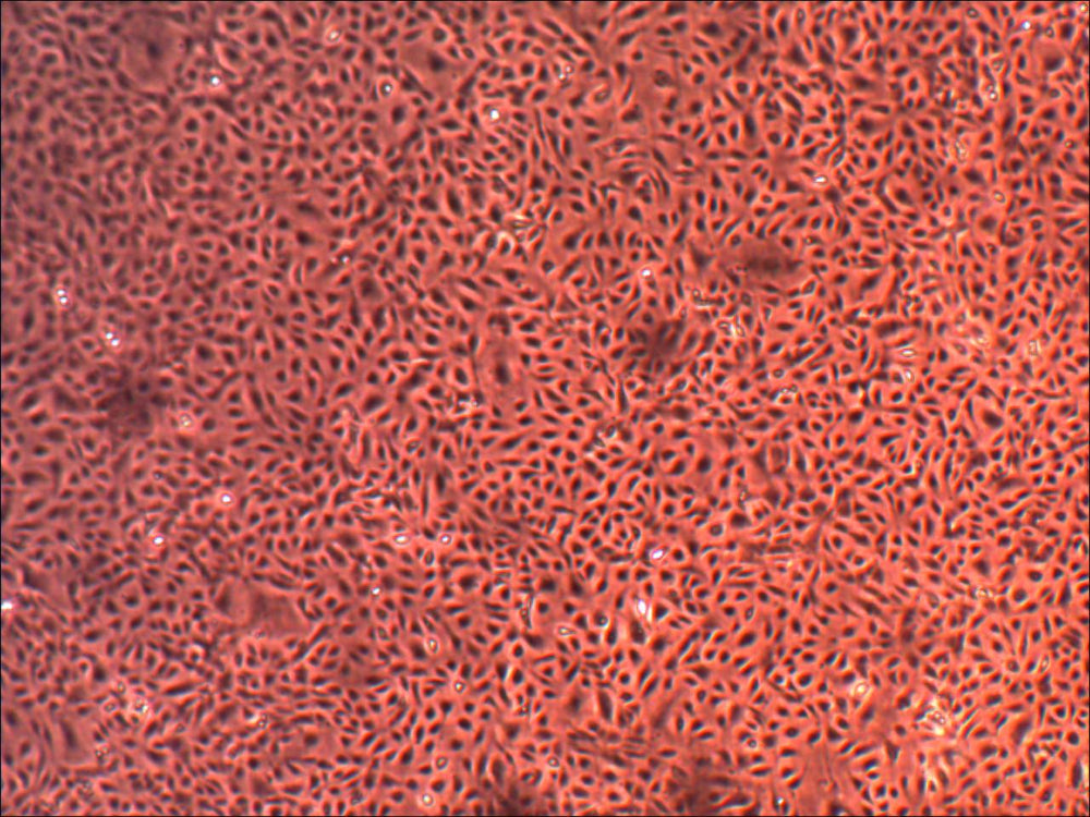 Cell Systems Primary Human Lung Microvascular Endothelial Cells (ACBRI 468)