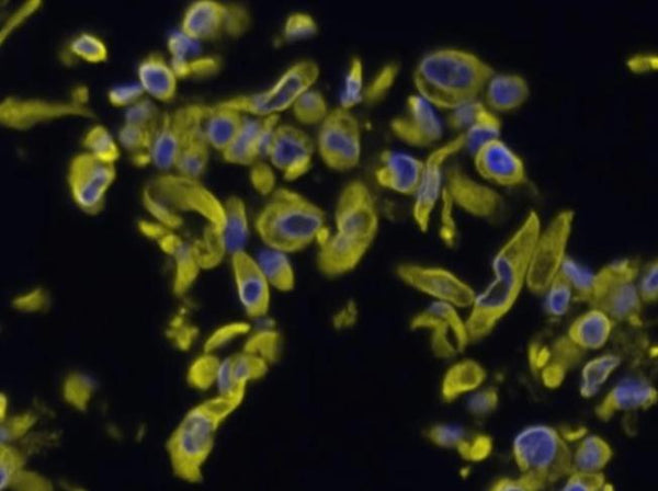 Primary Human Lung Fibroblast Cells Cell Systems