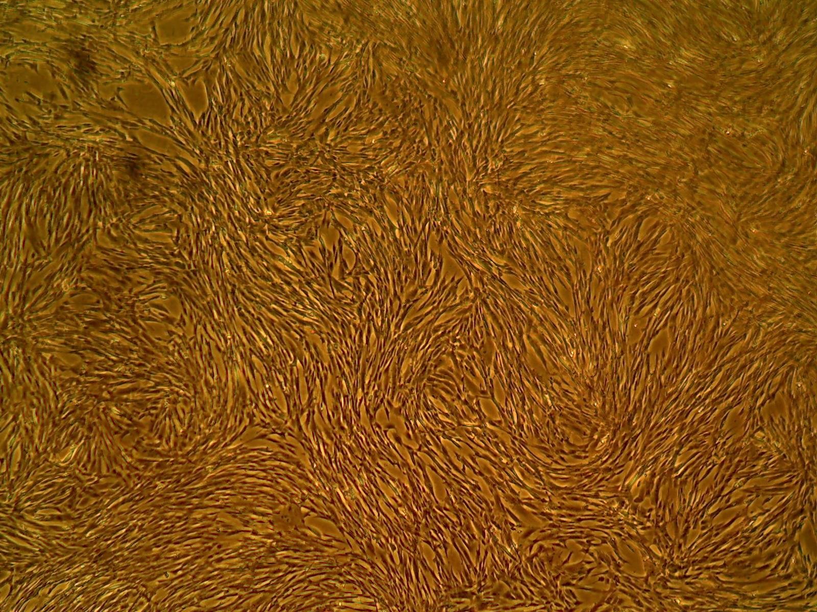 Primary Human Glomerular Mesangial Cells (ACBRI 127)