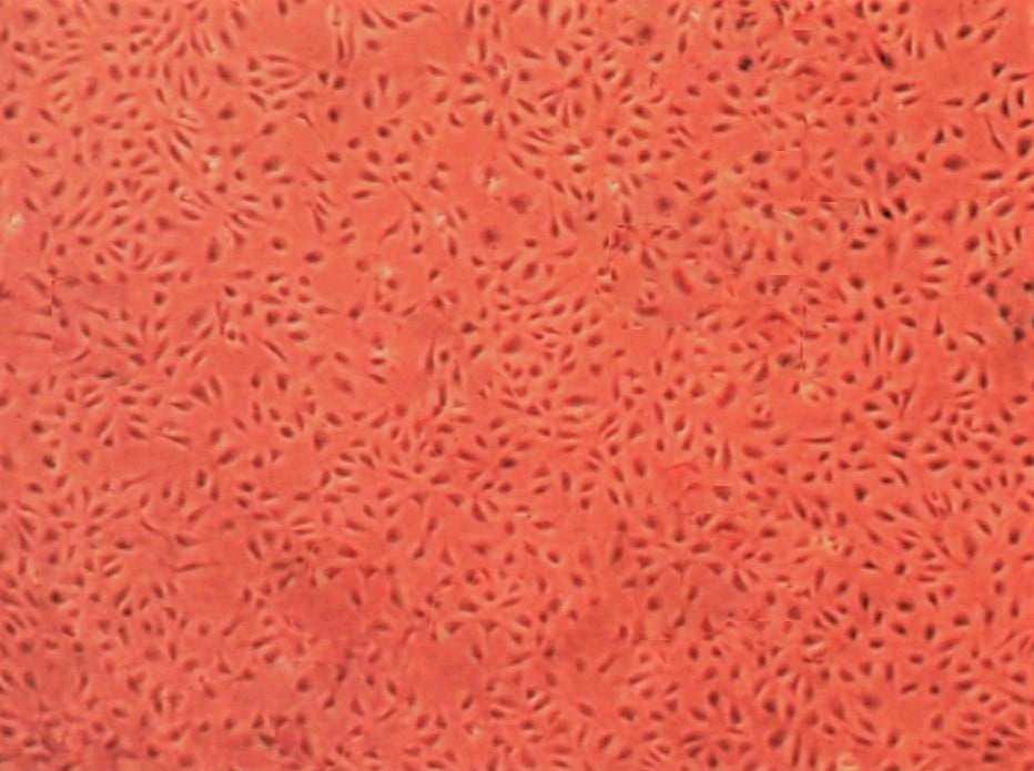 Primary Human Glomerular Mesangial Cells (ACBRI 127)