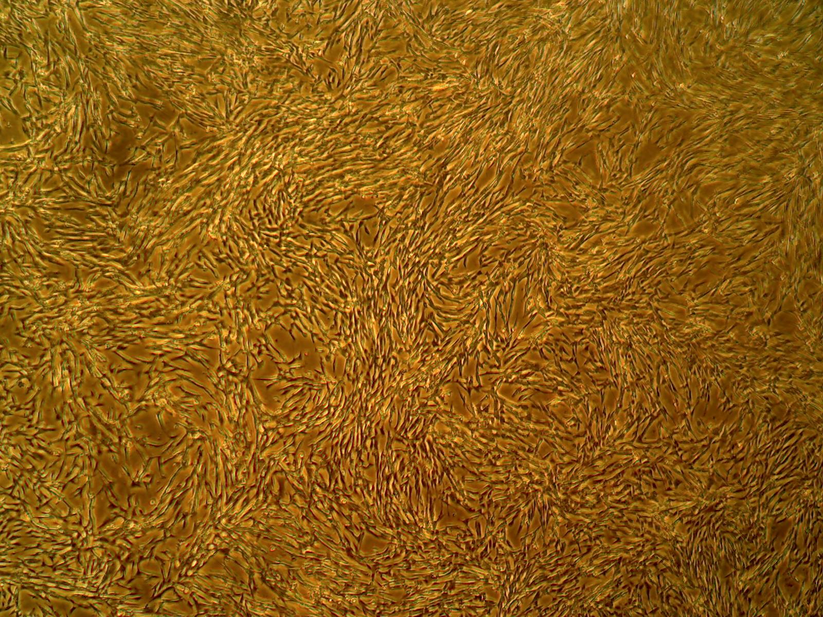 Primary Human Glomerular Mesangial Cells (ACBRI 127)