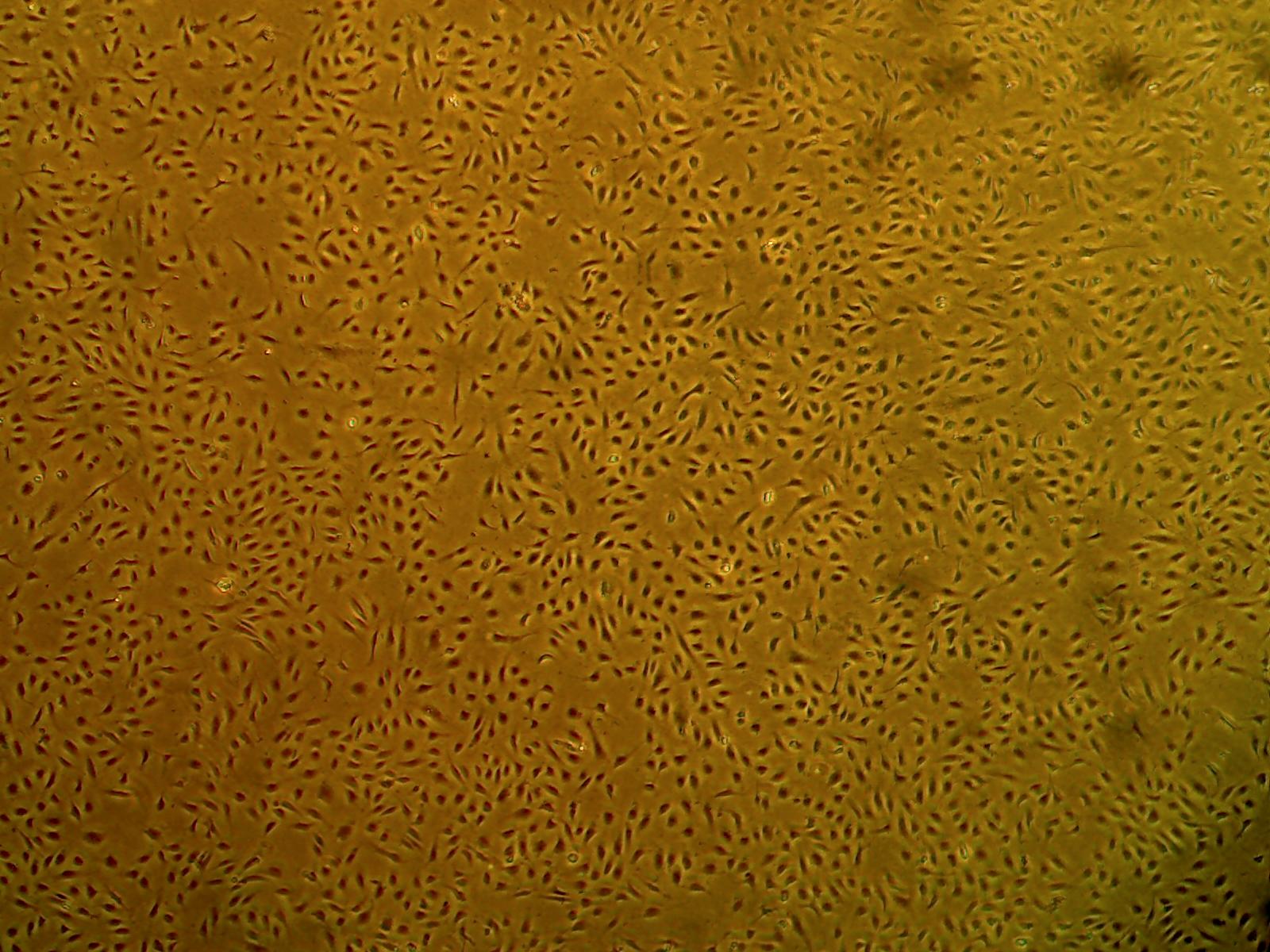 Cell Systems Primary Human Aortic Endothelial Cells (ACBRI 375) 
