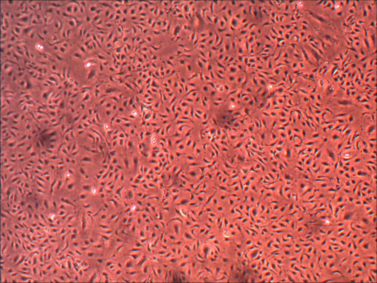 Primary Human Glomerular Mesangial Cells (ACBRI 127)