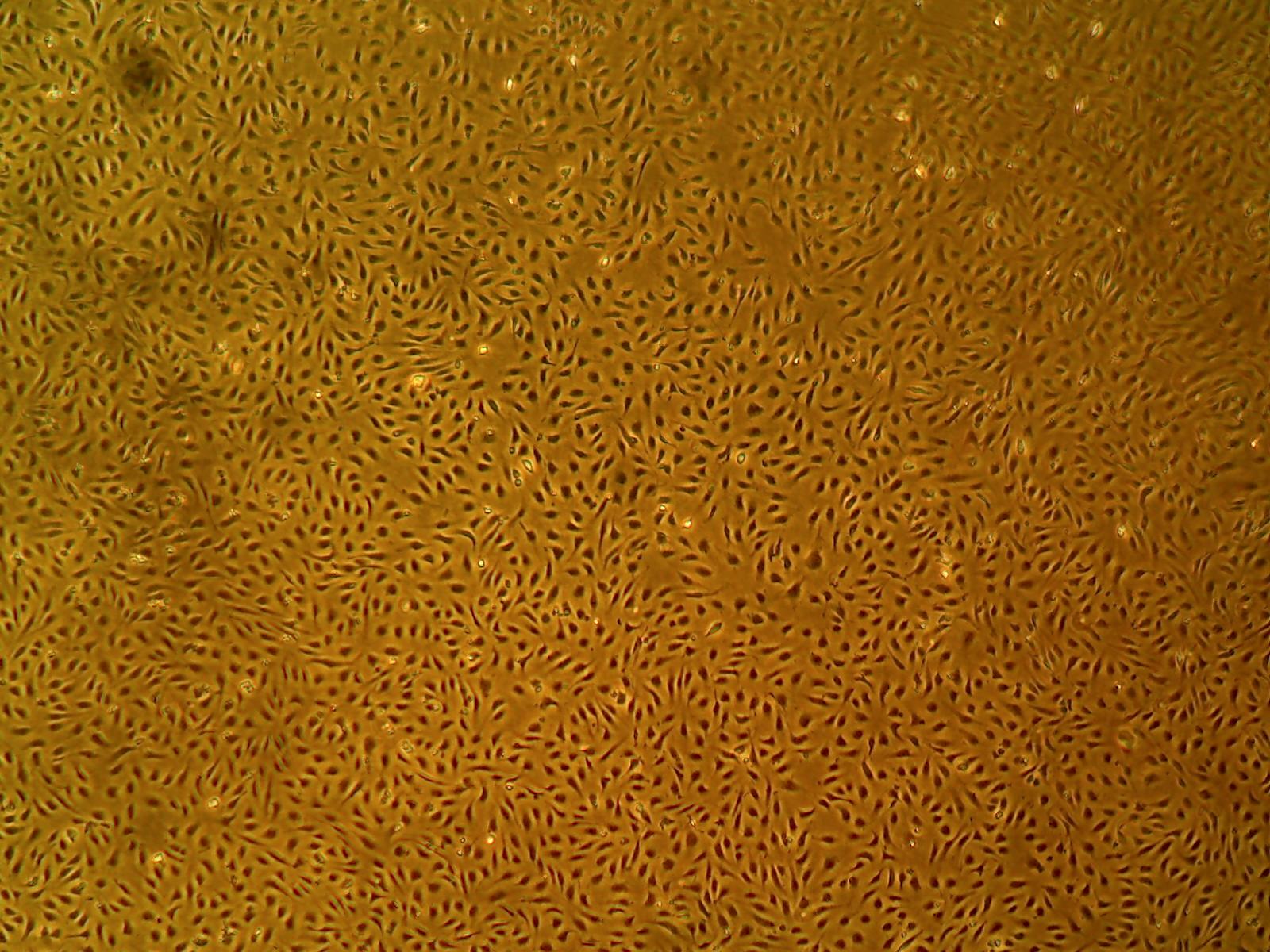 Primary Human Glomerular Mesangial Cells (ACBRI 127)