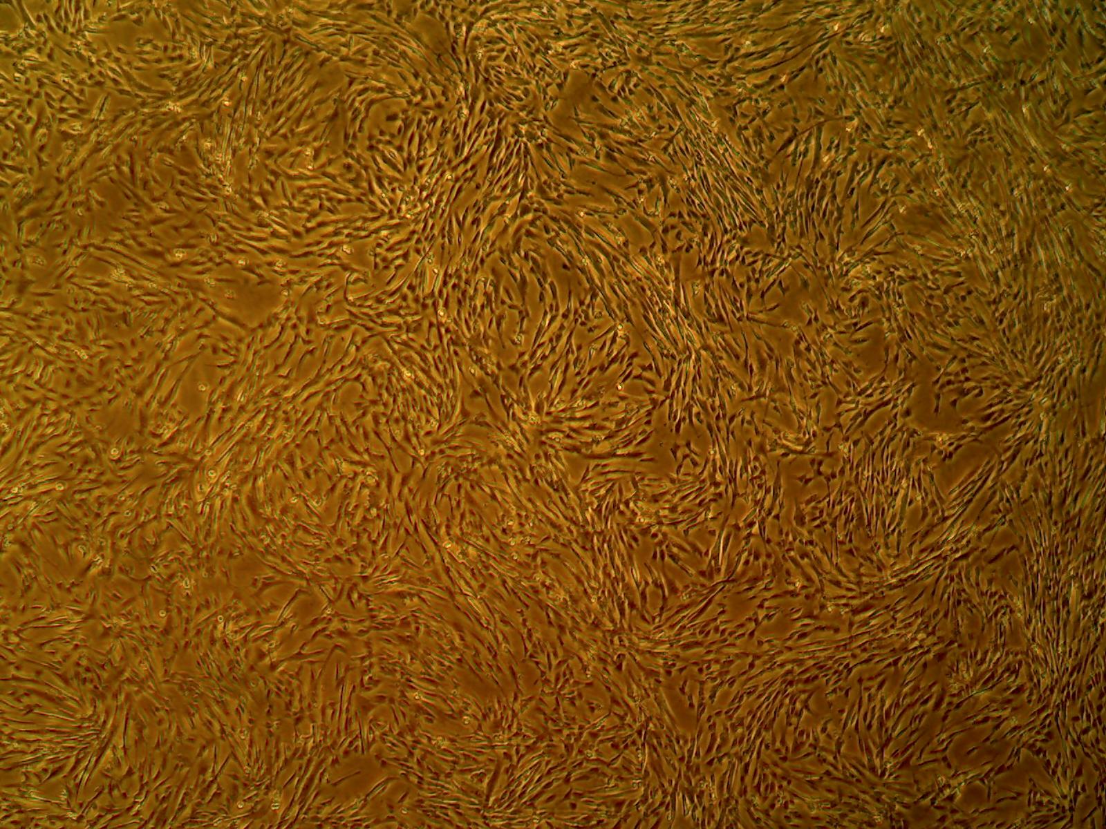 Primary Human Glomerular Mesangial Cells (ACBRI 127)