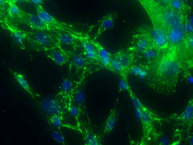 健康・医学 The Cell Human amyotrophic lateral sclerosis excitability phenotype