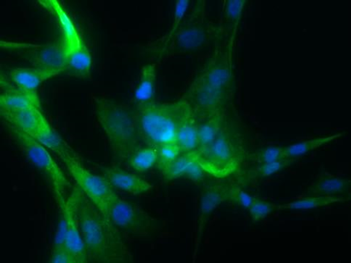 Human Aortic Smooth Muscle Cells (ACBRI 716)