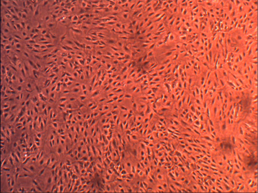 Primary Human Glomerular Mesangial Cells (ACBRI 127)